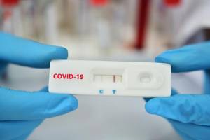 Υπ. Εργασίας: Ένα υποχρεωτικό rapid test την εβδομάδα για τους ανεμβολίαστους στον ιδιωτικό τομέα
