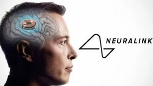 Neuralink: Ολοκληρώθηκε με επιτυχία η πρώτη εμφύτευση μικροτσίπ σε ανθρώπινο εγκέφαλο