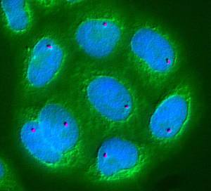 Poland: EIB to support Ryvu Therapeutics’ discovery, research and development of new cancer treatments with €22 million