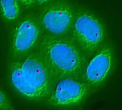 Poland: EIB to support Ryvu Therapeutics’ discovery, research and development of new cancer treatments with €22 million